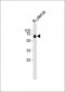 BMPR1A Antibody (N-term)